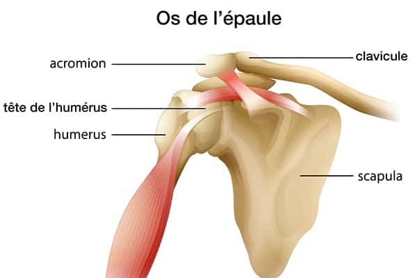 fracture de l humerus casse consolidation chirurgien orthopediste epaule paris 16 dr charles schlur specialiste epaule a paris