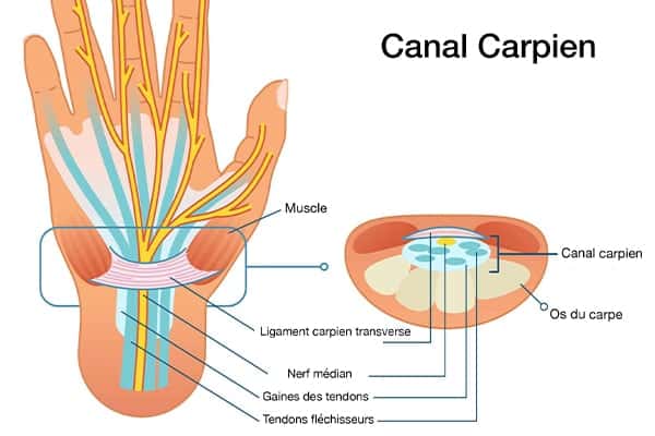 canal carpien quel medecin consulter comment soulager canal carpien chirurgien orthopediste epaule paris 16 dr charles schlur specialiste epaule a paris
