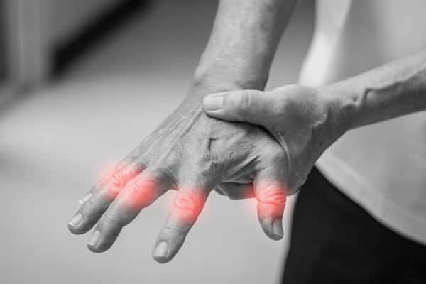 symtomes crise d arthrose de la main traitement arthrite main gonflee chirurgien orthopediste epaule paris 16 dr charles schlur specialiste epaule a paris