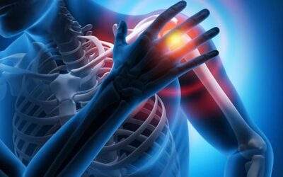 Rupture du tendon supra épineux : quel traitement privilégier ?